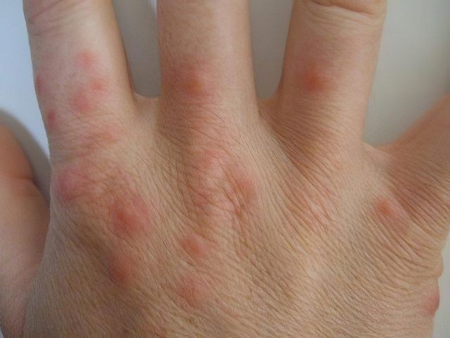images/insects/slider/insect-pest-control-3-kireth-ai.jpeg